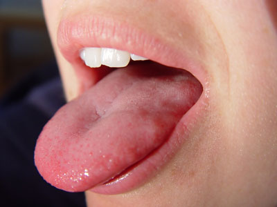 دلایل مزه بد دهان،درمان مزه بد دهان