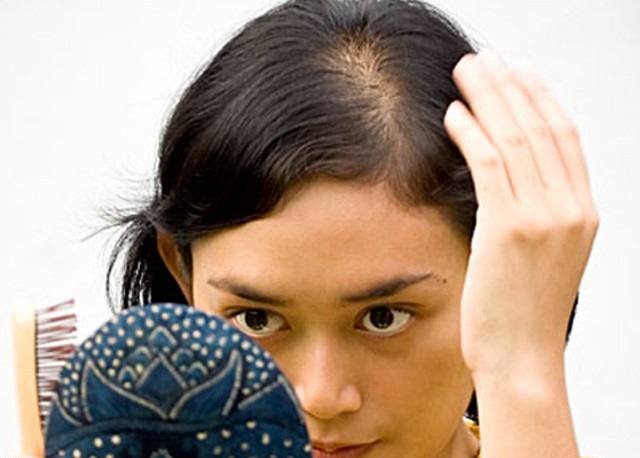 درمان و توقف ریزش مو با مواد طبیعی