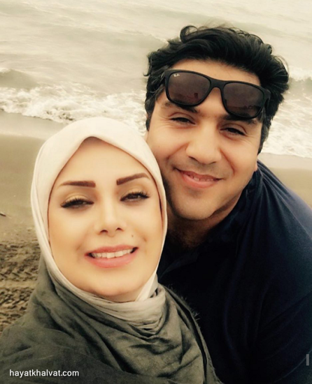 چهره هدیه تهرانی در 45 سالگی