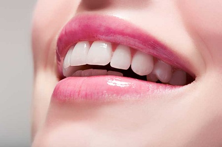 سفید کردن دندان ها بدون مواد شیمیایی