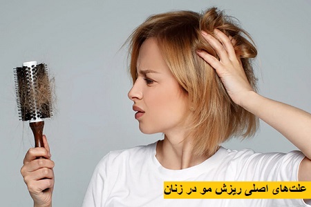 علتهای اصلی ریزش مو در زنان علتهای اصلی ریزش مو در زنان