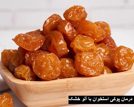 درمان طبیعی پوکی استخوان با آلو خشک درمان طبیعی پوکی استخوان با آلو خشک