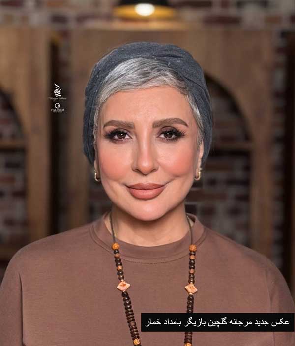 مرجانه گلچین بعد از عمل زیبایی مرجانه گلچین بعد از عمل زیبایی